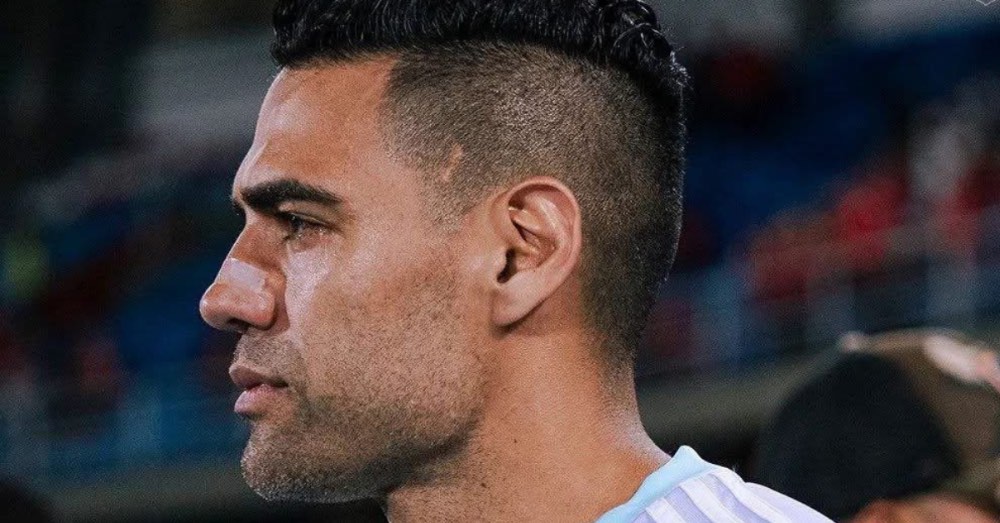 Millonarios confirma fractura facial de Falcao tras golpe en partido contra América de Cali